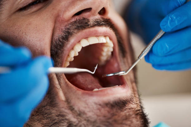 Best Emergency Root Canal Treatment in Arkoma, OK